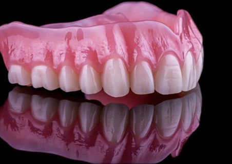 Traditional Dentures